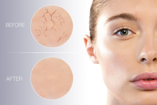 5 Signs Your Skin Is Dehydrated And How To Deal With It