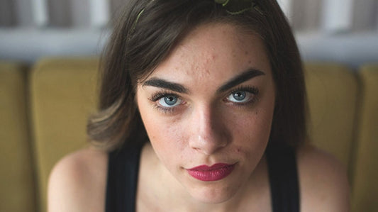 The Best Diet For Oily Skin: 8 Foods That Keep Oil And Pimples at Bay