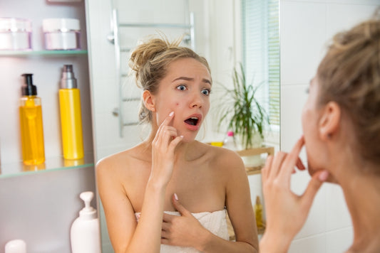 Can Stress Cause Acne?