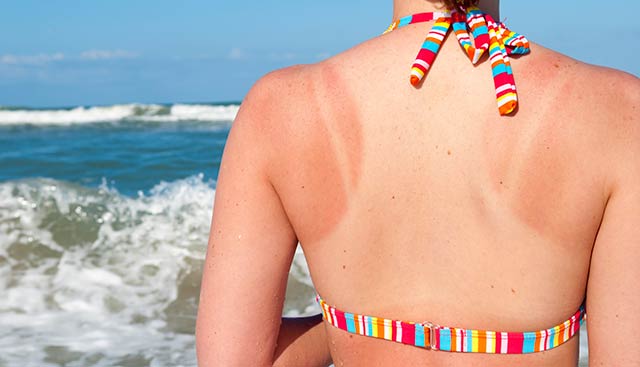 5 Sunscreen Myths You Need To Stop Believing Right Now