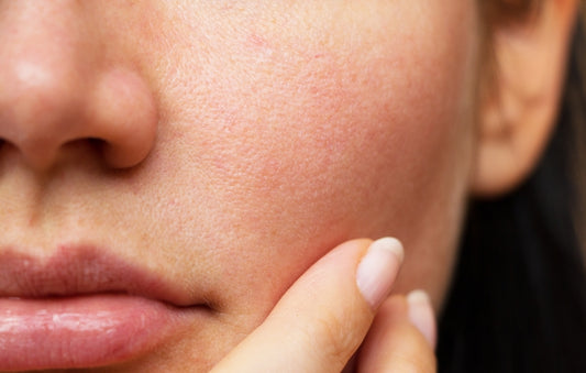 5 Common Pore Myths You Should Stop Believing Now