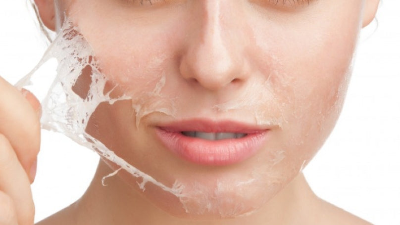 The Complete Guide To At-Home Chemical Peels