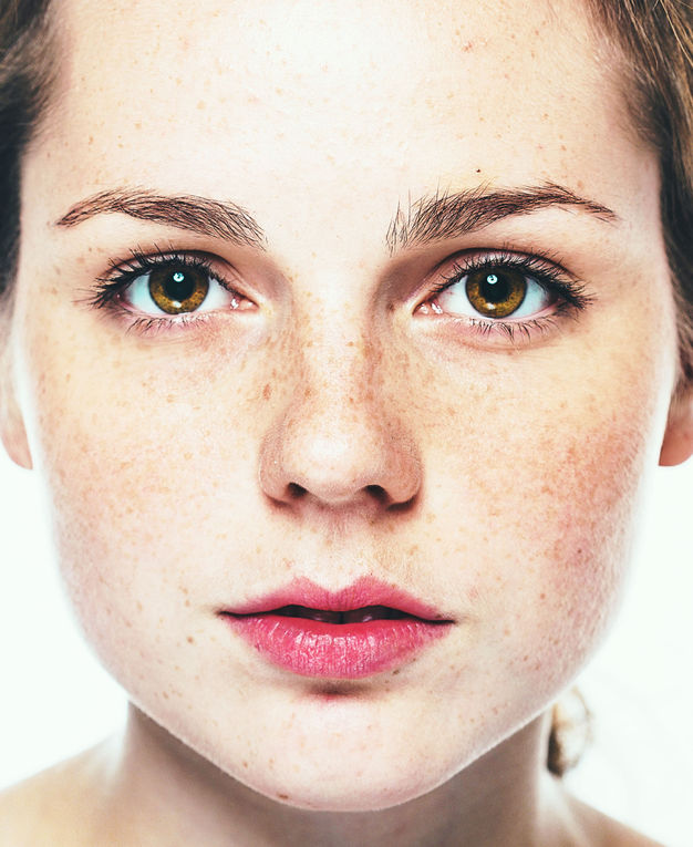 The Complete Guide to Treating Dark Spots